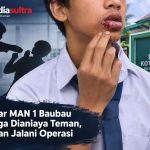 Pelajar MAN 1 Baubau Diduga Dianiaya Teman, Korban Jalani Operasi